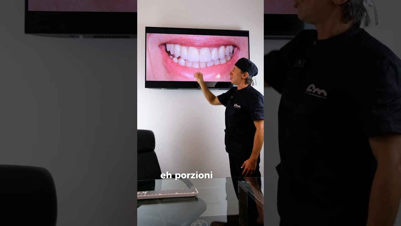 Riabilitazione completa dell'arcata superiore