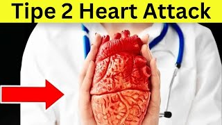 About Your Heart Attack