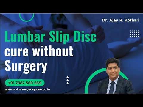 Lumbar Slip disc cure without surgery