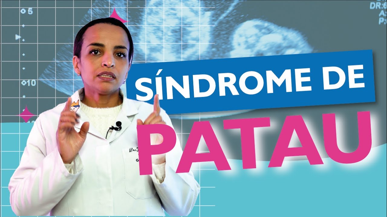 👉Síndrome de Patau, você conhece essa doença rara? Aprenda com profissionais👩‍⚕️🏥