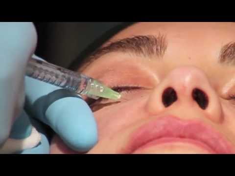 Risposte multidaddio di ringiovanimento di crema per il viso di notte Come cè un laser epilation su una faccia