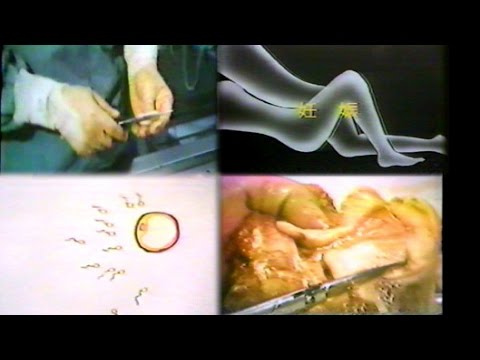 生殖器の機能◆子宮・睾丸を切り開くと・・・【医学ビデオ】
