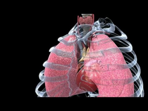 Sciences - Un jumeau numérique pour se soigner