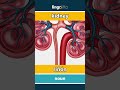 kidney - riñón video thumbnail