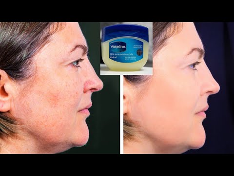 how to remove pimples Dark spot red spot dark circles...