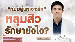 วิธีรักษาหลุมสิว