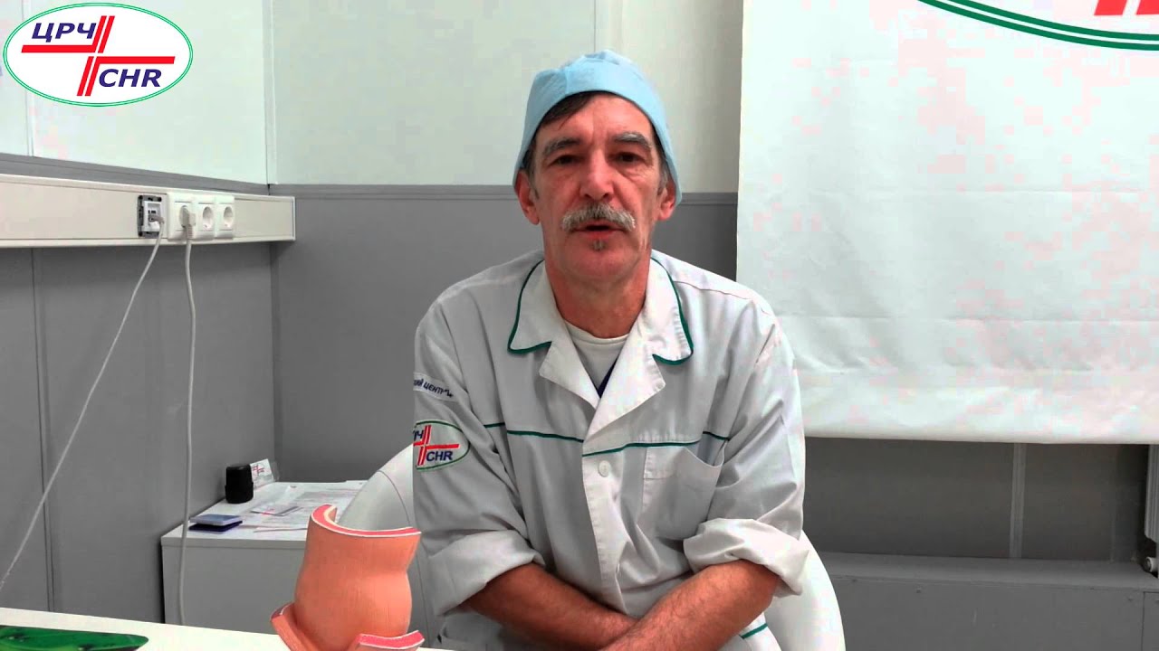 Выпадение прямой кишки