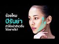 ร้อยไหม