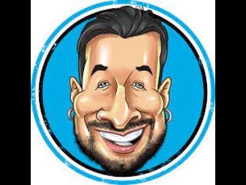 Implante capilar a AlexGiraldo de "Los Montañeros" realizado en Mediarte Medical Center