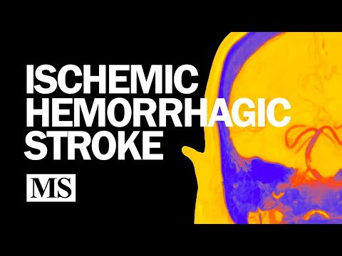 Introduction to Ischemic and Hemorrhagic Stroke (2025)