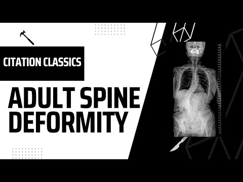 Spine Citation Classics: 05 Adult Spine Deformity