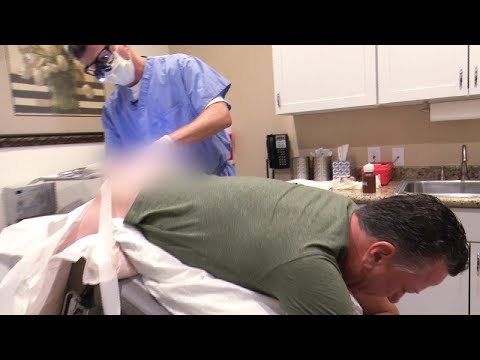 How Common Are Skin Tags in Sensitive Places?