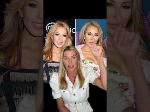 Lisa Hochstein Before Plastic Surgeries