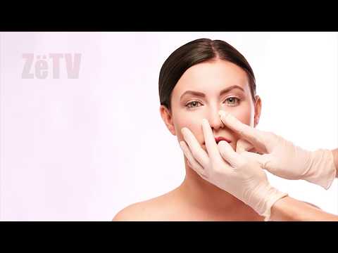 Septumi i devijuar - "Kuriozitete e këshilla mbi shëndetin"