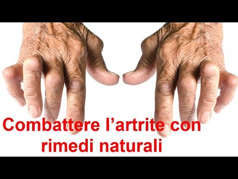 Dolore nella parte posteriore dà nelle natiche Artroscopia del ginocchio nellartrite reumatoide