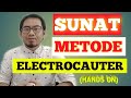 SUNAT METODE ELECTROCAUTER