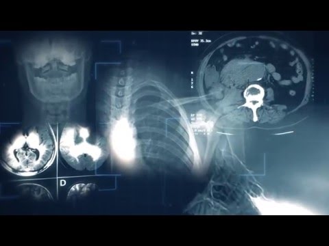 Rozpoznaj Chłoniaka - Przygotowanie do prawidłowej diagnozy