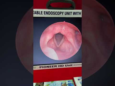 Arthoscopy Portable HD Unit