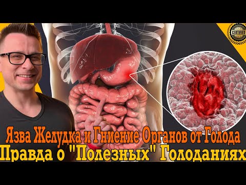 Язва желудка и гниение органов от голода! Вся правда о «ПОЛЕЗНЫХ» голоданиях! Язва желудка и гниение органов от голода! Вся правда о «ПОЛЕЗНЫХ» голоданиях!