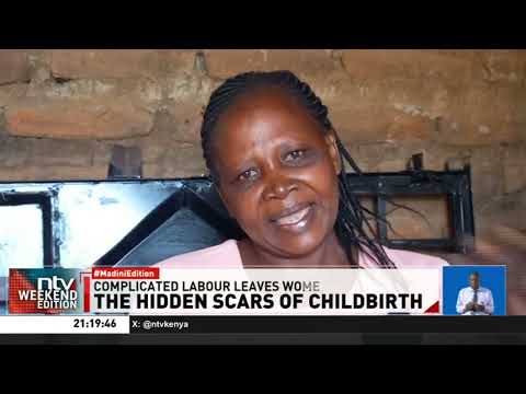 Shining light on hidden injuries after childbirth and the need for maternal recovery care