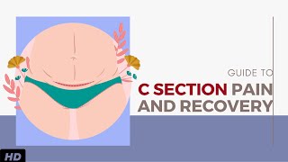 A Guide For C Section Pain And Recovery