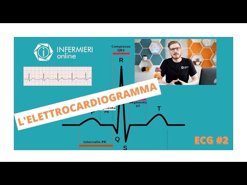 COS E' L' ELETTROCARDIOGRAMMA E COSA CI DICE | ECG #02 | INFERMIERI online