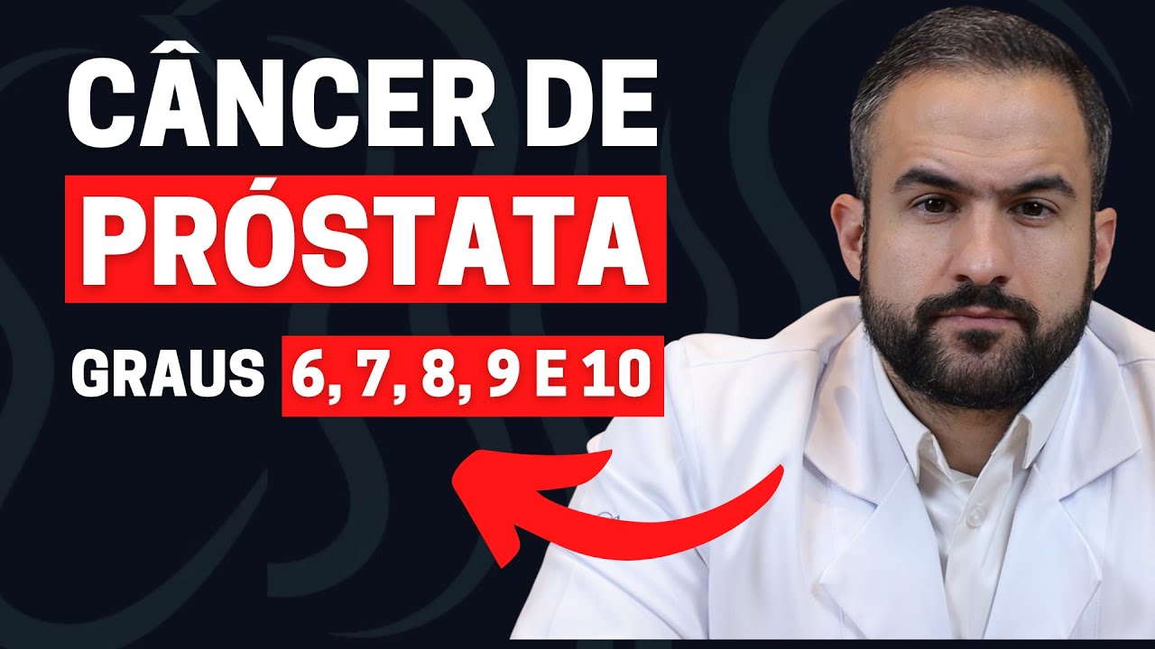 TIPOS DE TUMORES DE CÂNCER DE PRÓSTATA: BAIXO RISCO, INTERMEDIÁRIO E ALTO RISCO | DR. MATHEUS AMARAL