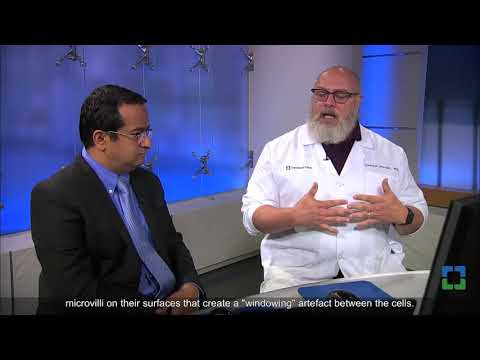 Pathology Insights: Pleural Fluid - Cyto-Histo Correlation