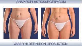 Shapiro Plastic Surgery