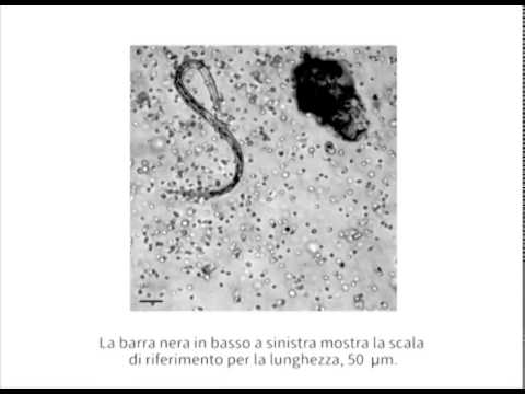 Trattamento di stagnazione nella prostata Urorek farmaco nel trattamento di BPH