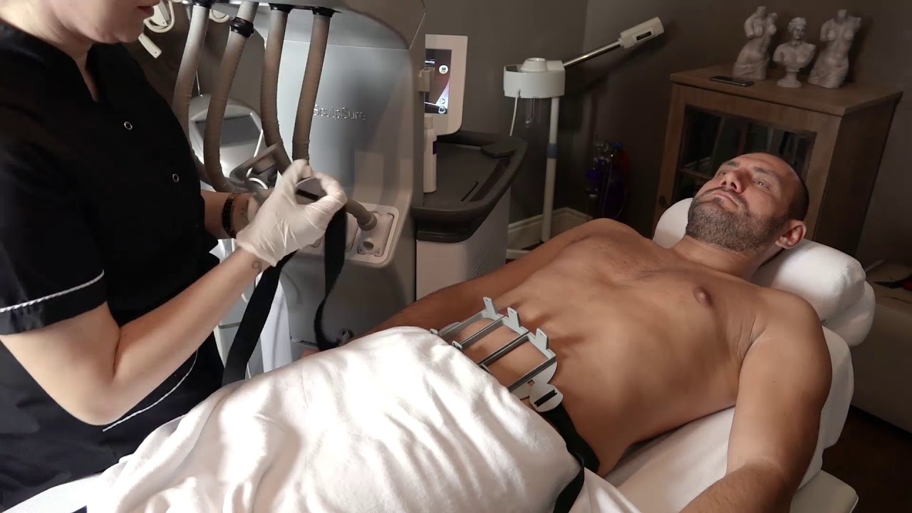 drhuseyintirman AMELİYATSIZ LAZER LİPOLİZ SCULPSURE