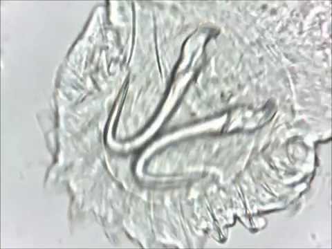 Vídeo: Penurias dun parasito