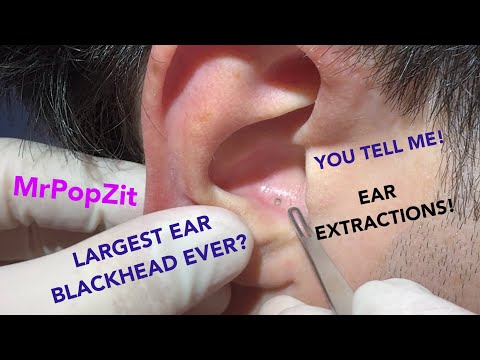 Drpopzit
