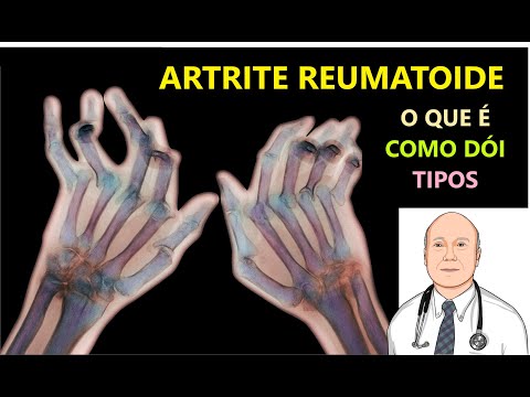 Rheumatoid ARTHRITIS PAIN, causes, types and early diagnosis.