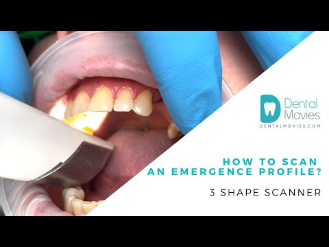 How to scan an emergence profile? 3 Shape scanner