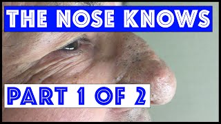 The Nose Knows: Part I  Mr Wilsons  Blackhead Extr