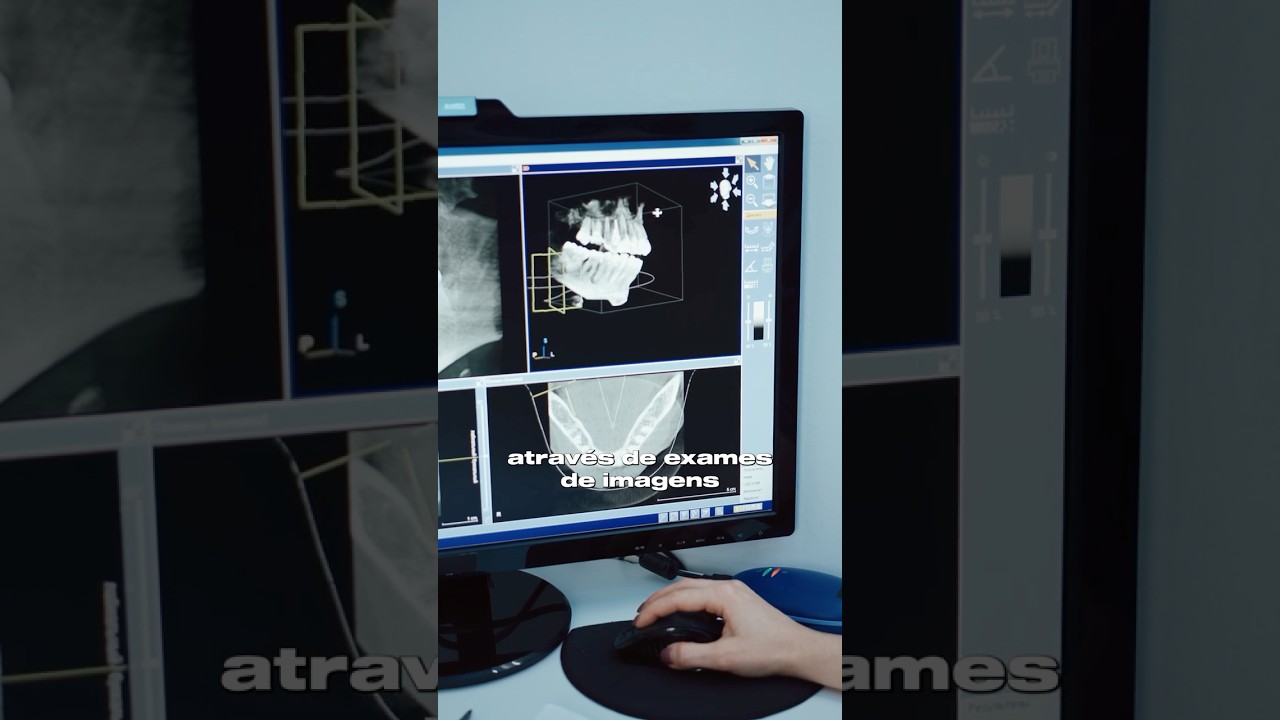 Vinicius Cavalcante-11