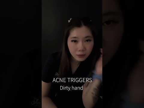 Top 3 Everyday Acne Triggers | Stop Pimples Now