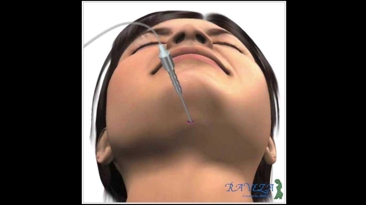 Carlos Luis Acosta Behrends-14