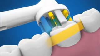 Oral B Triumph 5000 D34