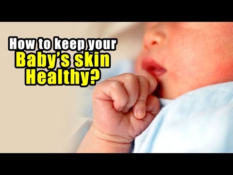 How to keep your baby’s skin healthy? Baby Skin Care Tips | Sushruta