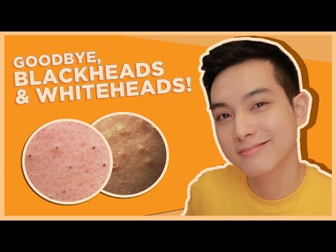 BEST SKINCARE for BLACKHEADS & WHITEHEADS! (OPEN & CLOSED COMEDONES) | Jan Angelo