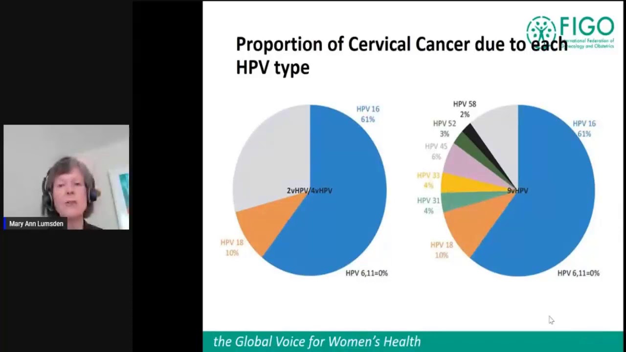 12 00 Mary Lumsden - Hemorragia Uterina Anormal en perimenopausia