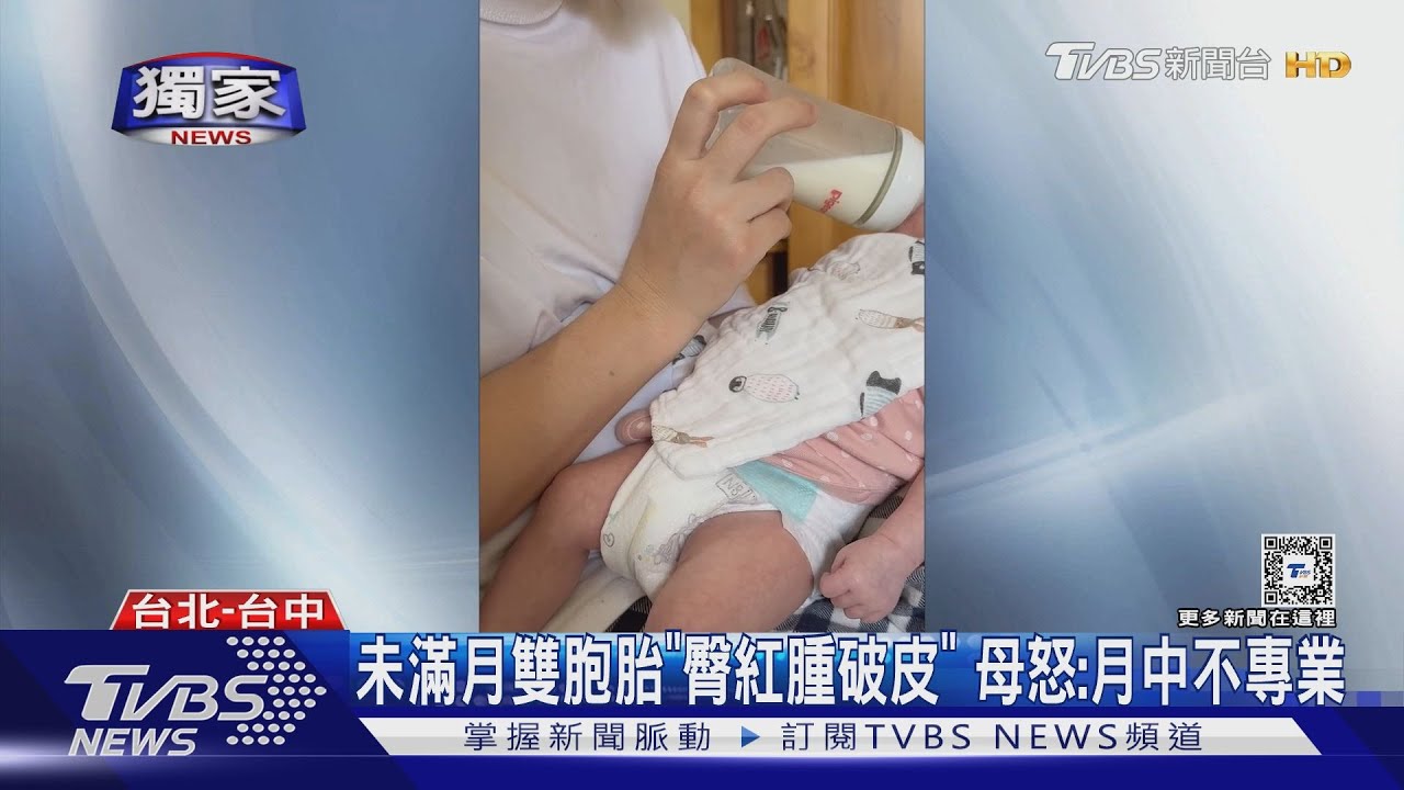 未滿月雙胞胎「臀紅腫破皮」 母怒:月中不專業