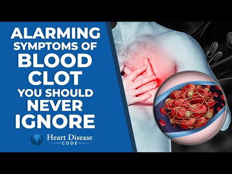 Alarming Symptoms of Blood Clots You Should Never Ignore