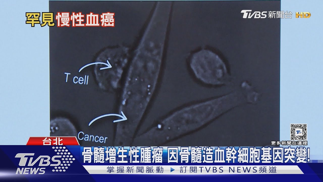 小心脾臟突然腫大1.5倍!就醫檢查發現罹「這疾病」 醫師:勿拖延速就醫!
