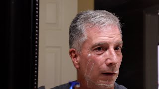 Mayo Clinic Minute - Shaving too close can cause skin problems