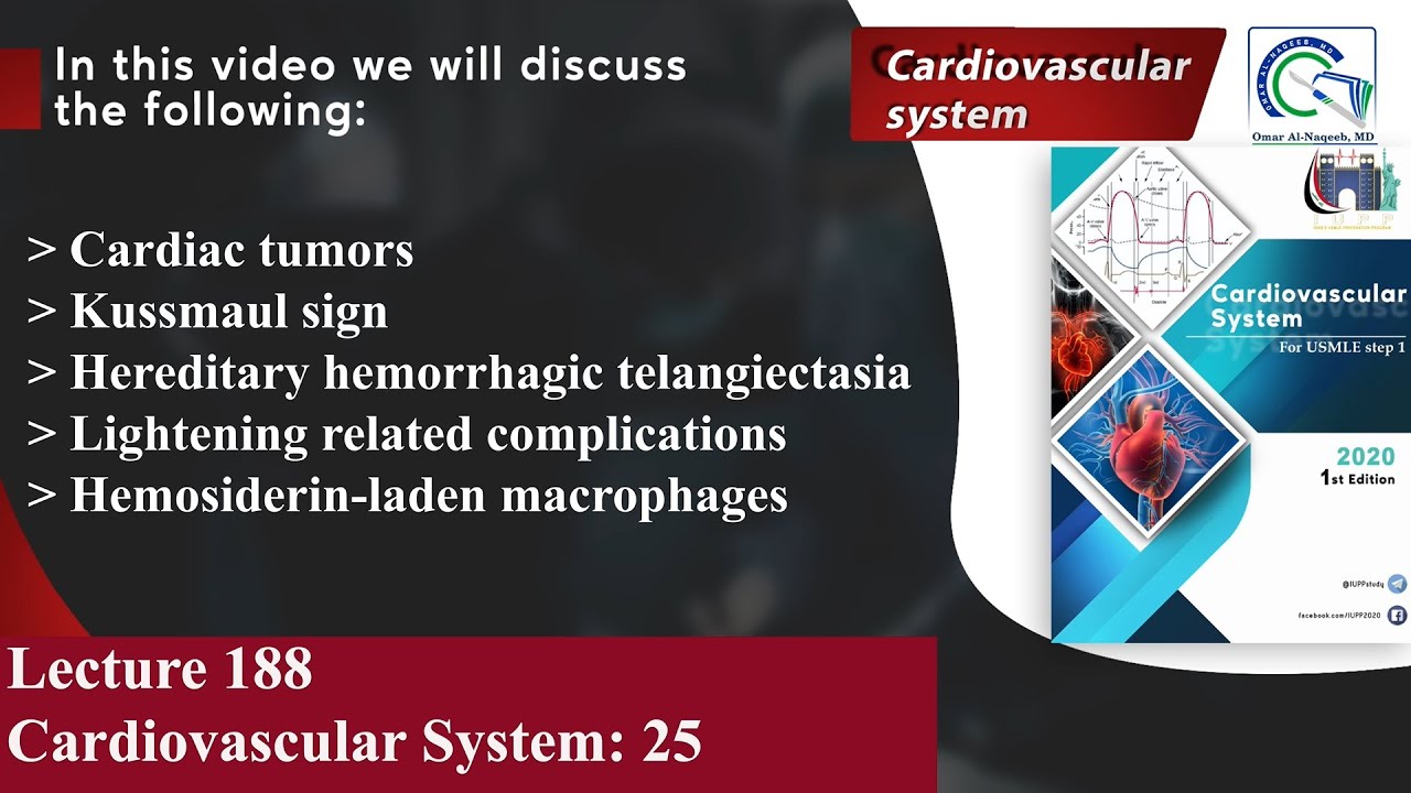 Cardiac tumors |Kussmaul sign |Hereditary hemorrhagic telangiectasia |Hemosiderin-laden macrophages