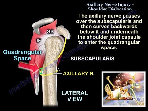 Axillary Nerve Injury Shoulder Dislocation - Everything You Need To Know - Dr. Nabil Ebraheim
