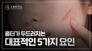 크리스탈성형외과 유튜브 영상